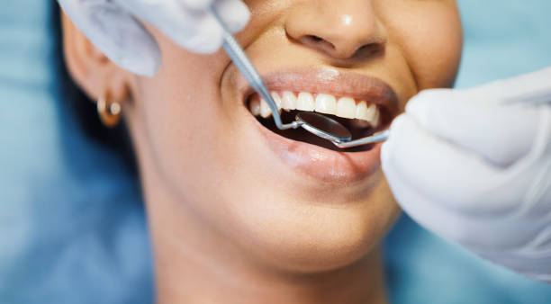 Best Dental Bonding  in Crowley, LA